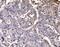 mRNA export factor antibody, A04228-2, Boster Biological Technology, Immunohistochemistry paraffin image 