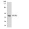 Prostaglandin E Receptor 2 antibody, LS-C200473, Lifespan Biosciences, Western Blot image 