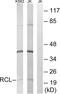 Deoxyribonucleoside 5 -monophosphate N-glycosidase antibody, abx014376, Abbexa, Western Blot image 