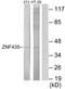 Zinc Finger And SCAN Domain Containing 16 antibody, GTX87871, GeneTex, Western Blot image 