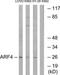 ADP Ribosylation Factor 4 antibody, TA313469, Origene, Western Blot image 