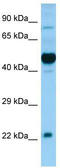Hypocretin Receptor 1 antibody, TA338269, Origene, Western Blot image 