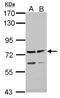 ADAM Metallopeptidase With Thrombospondin Type 1 Motif 5 antibody, GTX123657, GeneTex, Western Blot image 