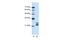 Cold Shock Domain Containing C2 antibody, A15485, Boster Biological Technology, Western Blot image 