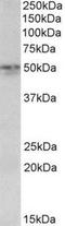 Synaptotagmin 2 antibody, NBP1-68859, Novus Biologicals, Western Blot image 