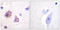 Protein Tyrosine Kinase 2 antibody, LS-C198952, Lifespan Biosciences, Immunohistochemistry frozen image 