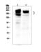 Zinc Finger E-Box Binding Homeobox 2 antibody, PA1959, Boster Biological Technology, Western Blot image 