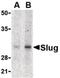 SNAI2 antibody, orb87358, Biorbyt, Western Blot image 