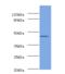 Proteasome 26S Subunit, Non-ATPase 11 antibody, MBS7001088, MyBioSource, Western Blot image 