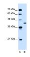 Poly(ADP-Ribose) Polymerase Family Member 10 antibody, orb330262, Biorbyt, Western Blot image 