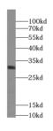 Zinc And Ring Finger 2 antibody, FNab09746, FineTest, Western Blot image 