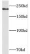 Treacle Ribosome Biogenesis Factor 1 antibody, FNab08562, FineTest, Western Blot image 