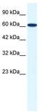 Zinc Finger Protein 266 antibody, TA339136, Origene, Western Blot image 