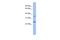 Necdin, MAGE Family Member antibody, A04394, Boster Biological Technology, Western Blot image 