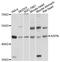 Asporin antibody, STJ112349, St John