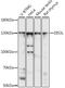 DIS3 Like Exosome 3'-5' Exoribonuclease antibody, A11644, Boster Biological Technology, Western Blot image 