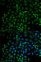 Beta-Transducin Repeat Containing E3 Ubiquitin Protein Ligase antibody, 16-657, ProSci, Immunofluorescence image 