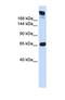 Sucrase-Isomaltase antibody, NBP1-69357, Novus Biologicals, Western Blot image 