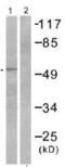 Retinoic Acid Receptor Beta antibody, ab53161, Abcam, Western Blot image 