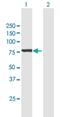 Glutamine-Fructose-6-Phosphate Transaminase 2 antibody, H00009945-B01P, Novus Biologicals, Western Blot image 