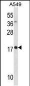 Myosin Light Chain 4 antibody, PA5-49205, Invitrogen Antibodies, Western Blot image 