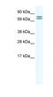 EST4A antibody, MBS834796, MyBioSource, Western Blot image 