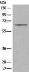 Centromere Protein T antibody, PA5-68397, Invitrogen Antibodies, Western Blot image 