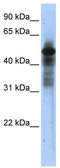 TOR antibody, TA332352, Origene, Western Blot image 