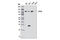 CYLD Lysine 63 Deubiquitinase antibody, 8462S, Cell Signaling Technology, Western Blot image 