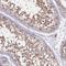 Hyaluronidase 3 antibody, HPA049402, Atlas Antibodies, Immunohistochemistry frozen image 