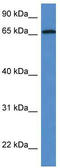 ASPSCR1 Tether For SLC2A4, UBX Domain Containing antibody, TA343130, Origene, Western Blot image 