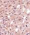 Matrilin 2 antibody, A06462-1, Boster Biological Technology, Immunohistochemistry paraffin image 