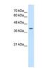 Wnt Family Member 2B antibody, NBP1-53123, Novus Biologicals, Western Blot image 