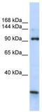 Membrane Integral NOTCH2 Associated Receptor 1 antibody, TA341965, Origene, Western Blot image 