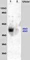 ARC/ARG3.1 antibody, orb10130, Biorbyt, Western Blot image 