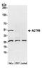 Actin Related Protein 6 antibody, A305-230A, Bethyl Labs, Western Blot image 