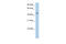 Phenylalanyl-TRNA Synthetase 2, Mitochondrial antibody, 29-387, ProSci, Enzyme Linked Immunosorbent Assay image 