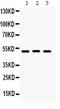 Bone Morphogenetic Protein 5 antibody, GTX03273, GeneTex, Western Blot image 