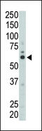 FYN Proto-Oncogene, Src Family Tyrosine Kinase antibody, 63-161, ProSci, Western Blot image 