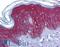 Junction Plakoglobin antibody, LS-B6046, Lifespan Biosciences, Immunohistochemistry frozen image 