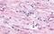 Cl2 antibody, NLS1132, Novus Biologicals, Immunohistochemistry paraffin image 