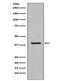 Keratin 19 antibody, M02101-1, Boster Biological Technology, Western Blot image 