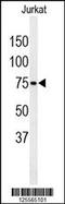 PAB-dependent poly(A)-specific ribonuclease subunit 3 antibody, 61-731, ProSci, Western Blot image 