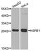Heat Shock Protein Family B (Small) Member 1 antibody, A0240, ABclonal Technology, Western Blot image 
