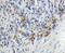 Signal Recognition Particle 14 antibody, 11528-1-AP, Proteintech Group, Immunohistochemistry paraffin image 