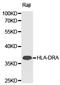 Major Histocompatibility Complex, Class II, DR Alpha antibody, LS-C192791, Lifespan Biosciences, Western Blot image 
