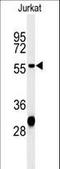 Hydroxyacyl-CoA Dehydrogenase Trifunctional Multienzyme Complex Subunit Beta antibody, LS-C166777, Lifespan Biosciences, Western Blot image 