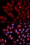 Protein TBRG4 antibody, LS-C330889, Lifespan Biosciences, Immunofluorescence image 