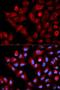 Transforming Growth Factor Beta Regulator 4 antibody, LS-C330889, Lifespan Biosciences, Immunofluorescence image 