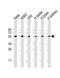 Preferentially Expressed Antigen In Melanoma antibody, GTX03381, GeneTex, Western Blot image 